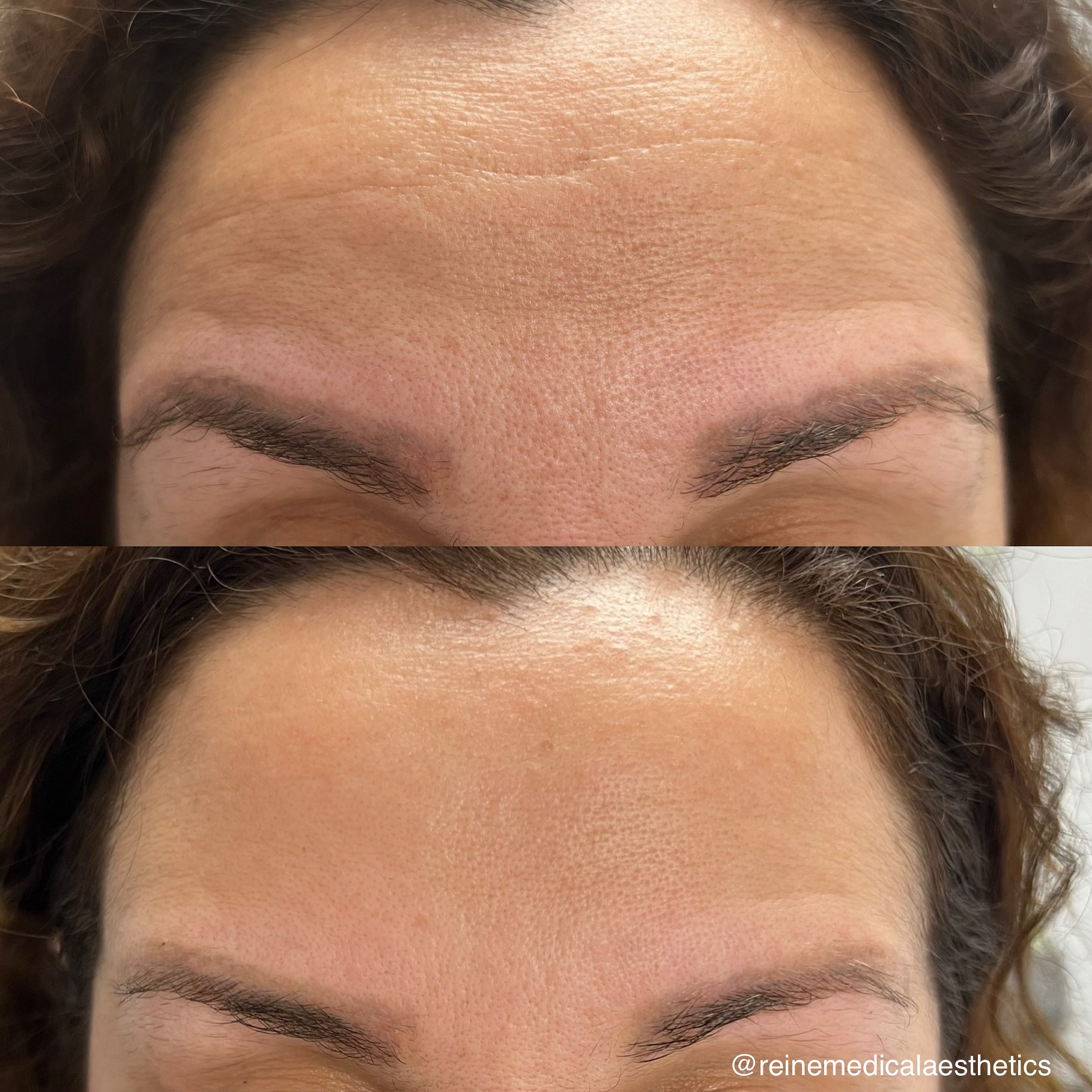 Reine Médico-Esthétique