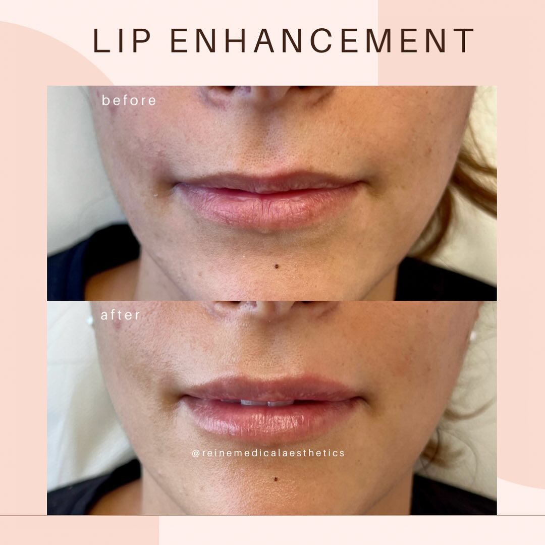 Reine Médico-Esthétique