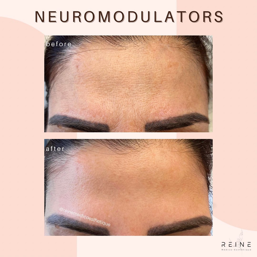 Reine Médico-Esthétique