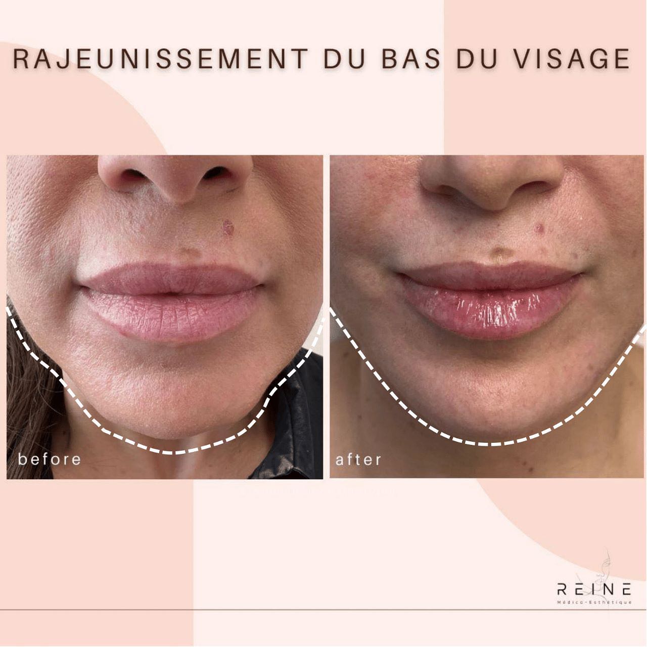 Reine Médico-Esthétique